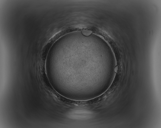 X0000085741158200703231104
