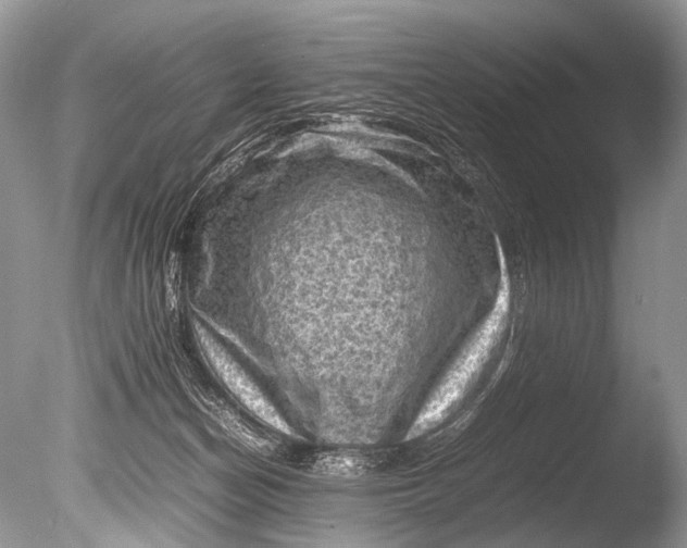 X0000085740174200703301437