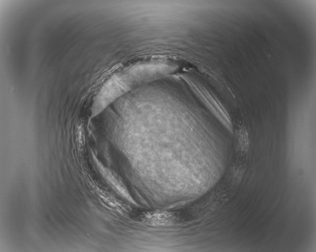 X0000085740517200703301431