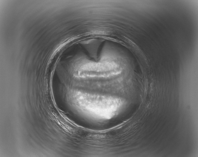 X0000085741027200703301422