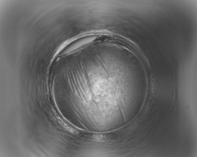 X0000085741176200703301420