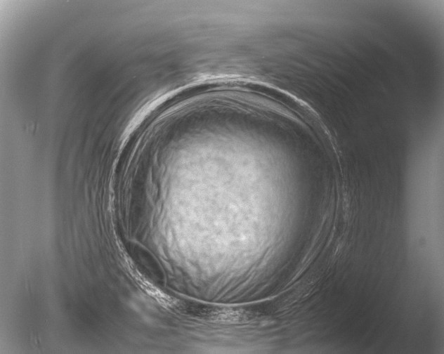 X0000085741279200703301418
