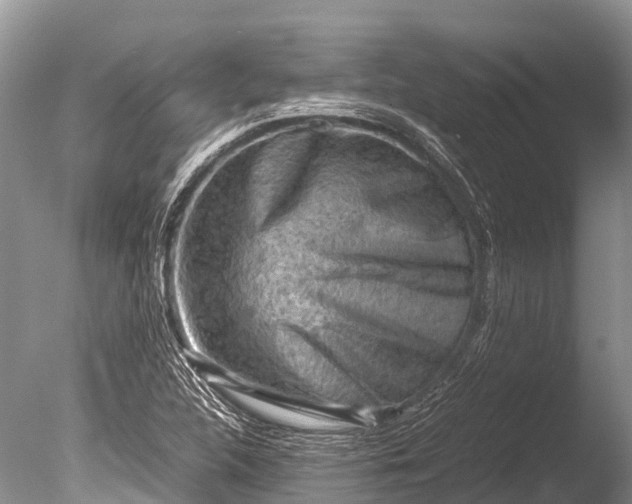 X0000085741312200703301417