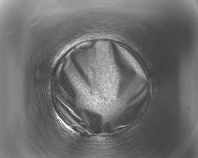 X0000085741500200703301414