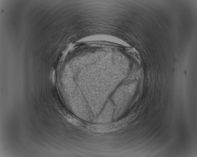 X0000085740041200704091521