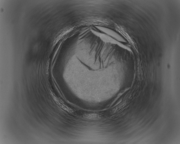 X0000085740058200704091520