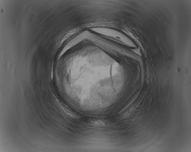 X0000085740062200704091520