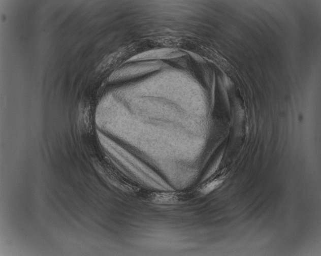 X0000085740088200704091521