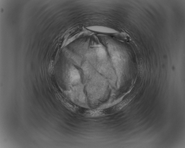 X0000085740093200704091521