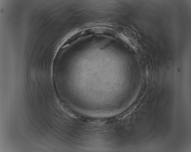 X0000085740148200704091518