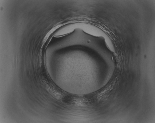 X0000085740200200704091518