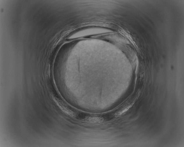 X0000085740205200704091518