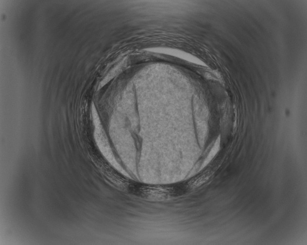 X0000085740229200704091518
