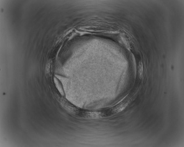 X0000085740233200704091518