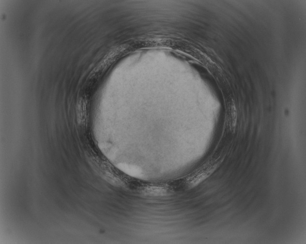 X0000085740236200704091518