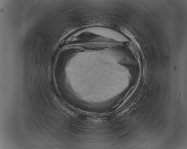 X0000085740249200704091517