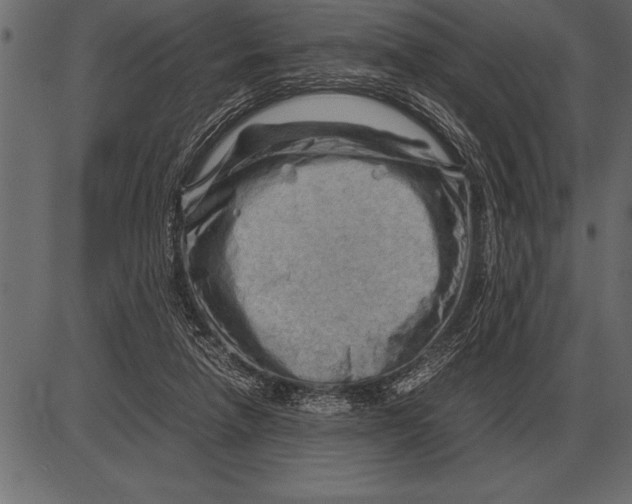 X0000085740258200704091517