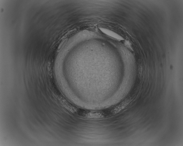 X0000085740270200704091517