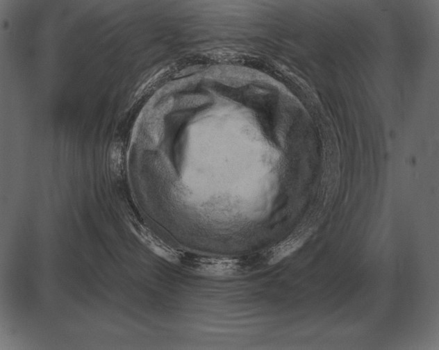 X0000085740288200704091518