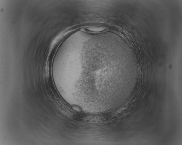 X0000085740294200704091517