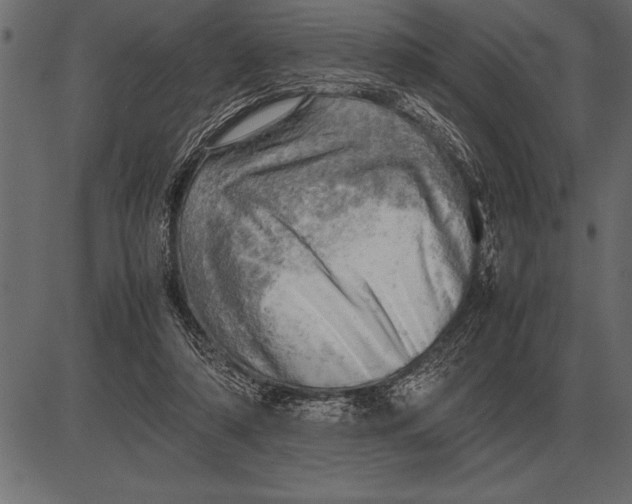 X0000085740306200704091516