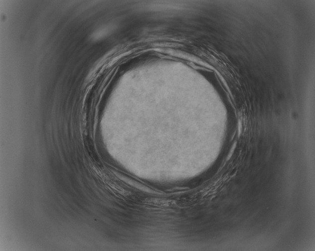 X0000085740339200704091515