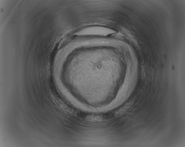 X0000085740354200704091515