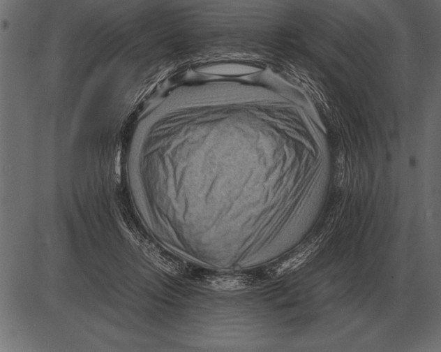 X0000085740358200704091516