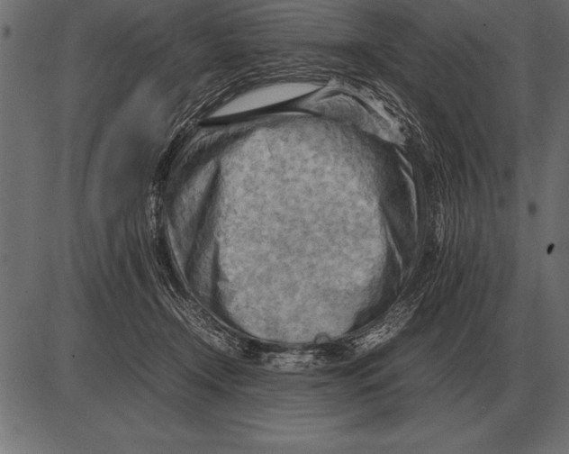 X0000085740366200704091516
