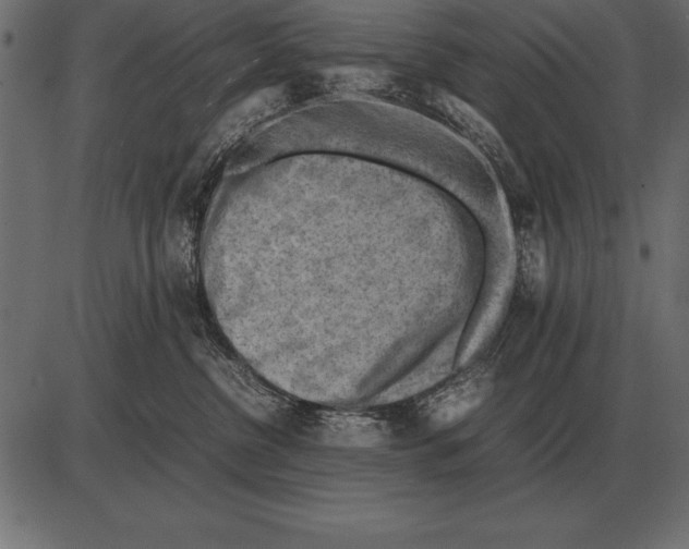 X0000085740380200704091516