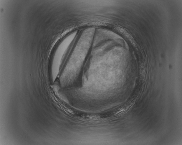 X0000085740395200704091515