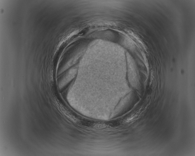 X0000085740399200704091515