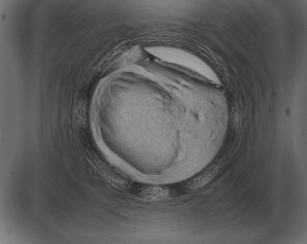 X0000085740421200704091515