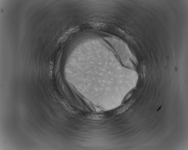X0000085740664200704091511