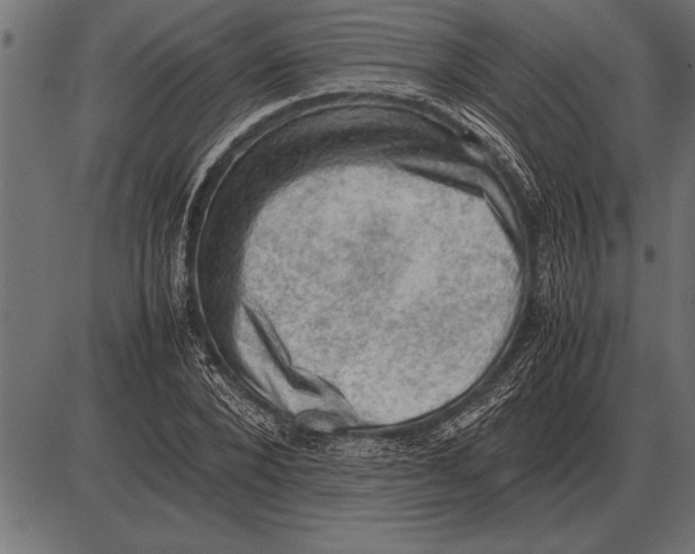 X0000085740880200704091507