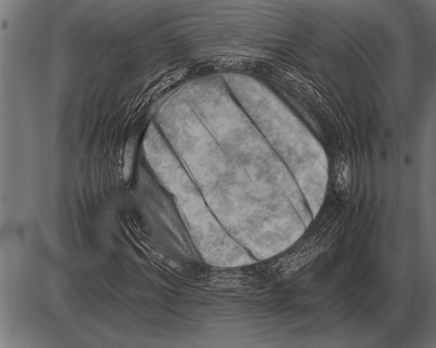 X0000085740964200704091506