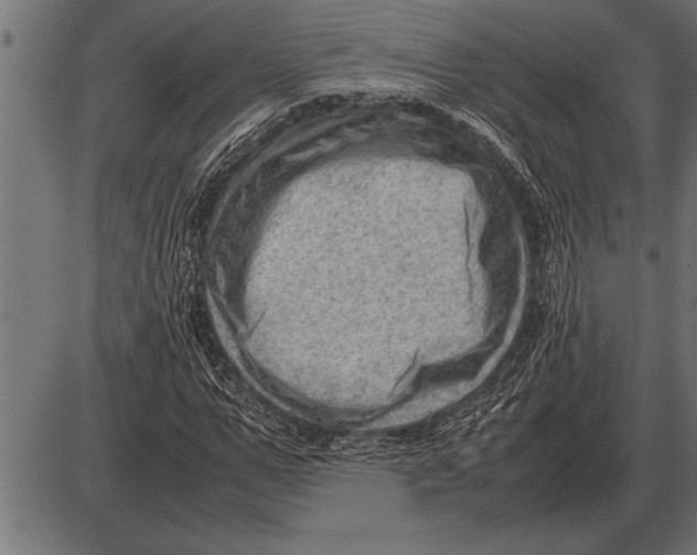 X0000085740967200704091505