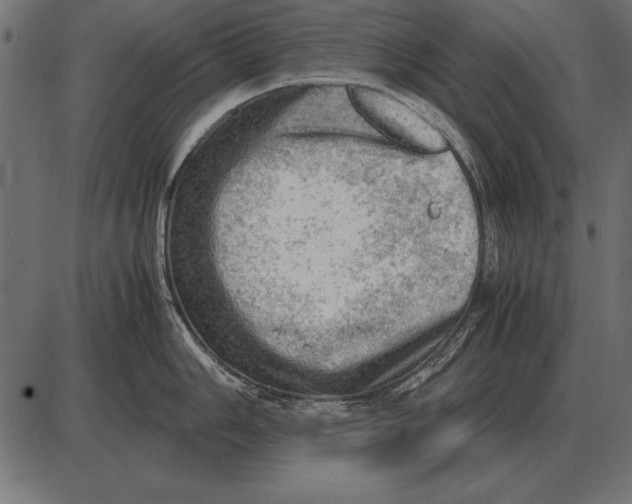 X0000085741006200704091505