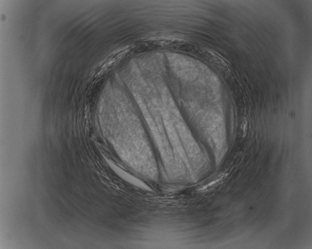X0000085741014200704091504