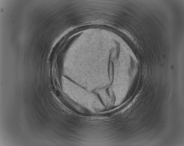 X0000085741118200704091503