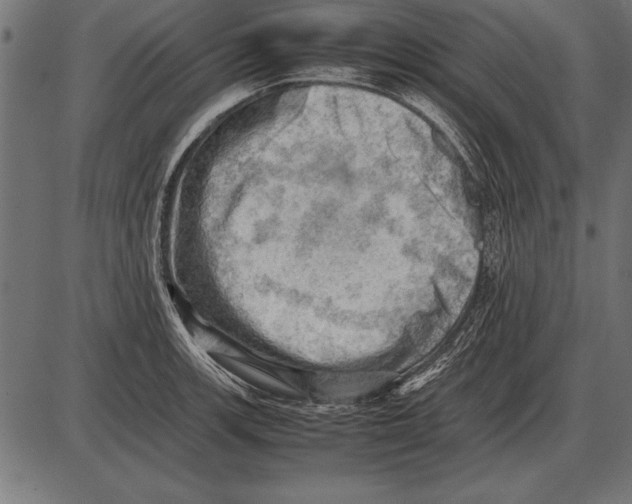 X0000085741139200704091503