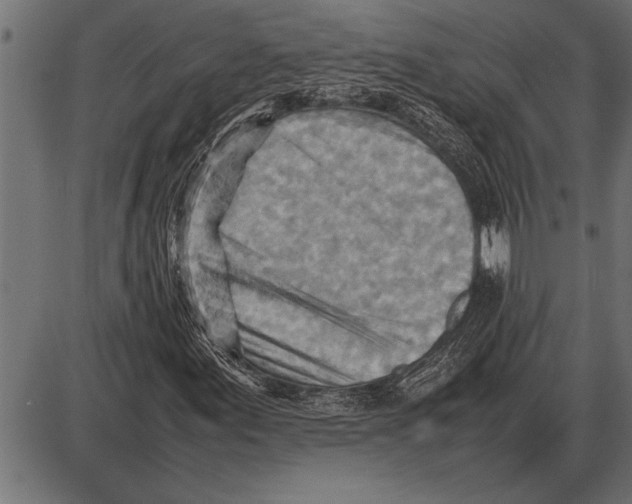 X0000085741155200704091502
