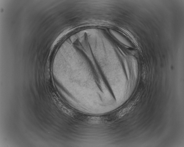 X0000085741172200704091502