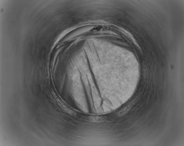 X0000085741176200704091502