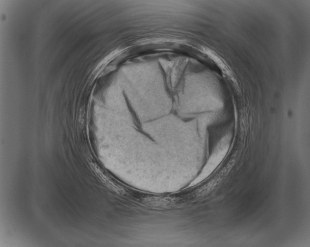 X0000085741185200704091502