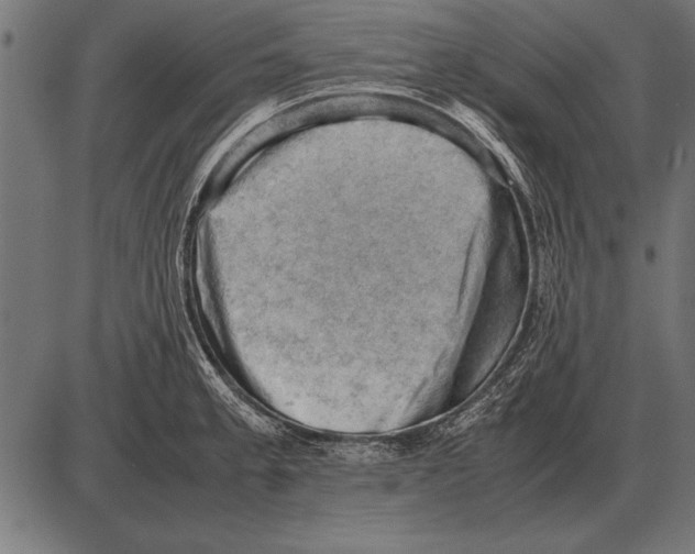 X0000085741189200704091502