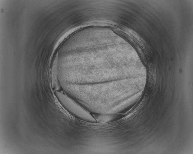 X0000085741192200704091502