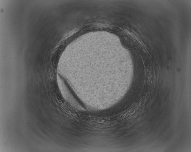 X0000085741207200704091501