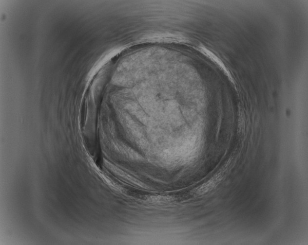 X0000085741277200704091500