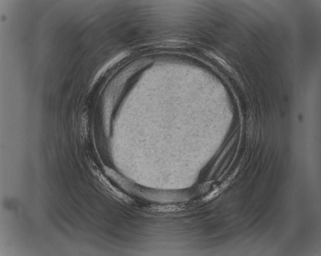 X0000085741402200704091458